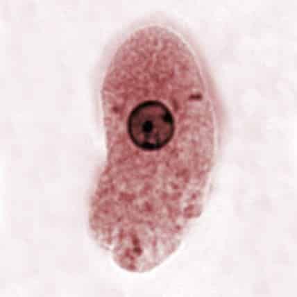 dissenteria dissenteria