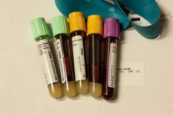 Analisi del sangue complete