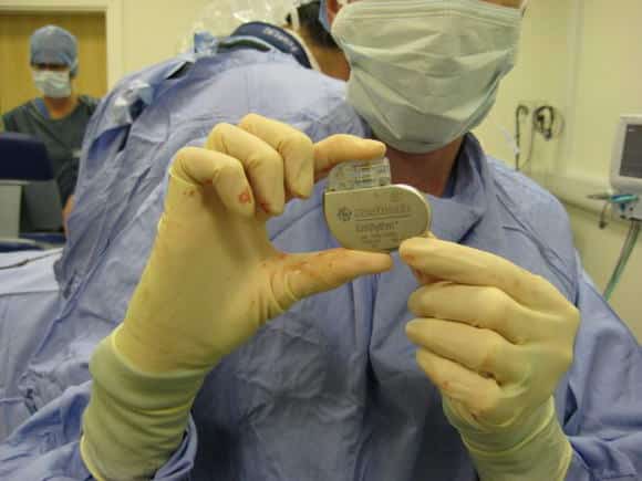 Cos Il Pacemaker A Cosa Serve E Quando Va Fatta L operazione