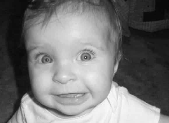 congiunvite-bambini congiuntivite nei bambini