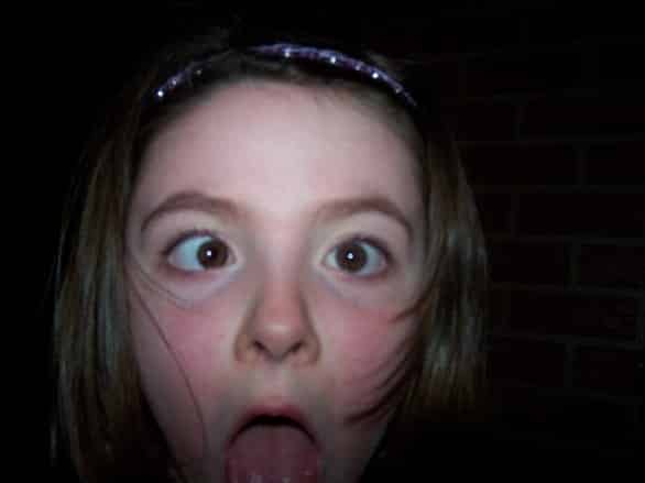 strabismo-nei-bambini Strabismo nei bambini