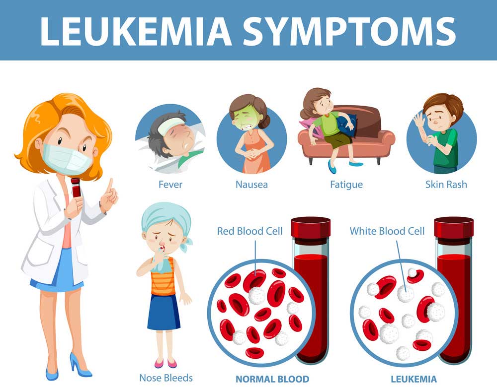 Quali-sono-i-sintomi-della-leucemia
